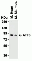 Anti-ATF6 antibody used in Western Blot (WB). GTX15457
