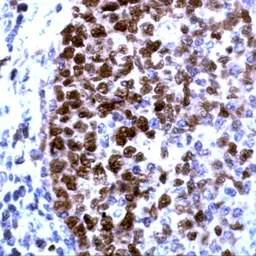 Anti-PCNA antibody used in IHC (Paraffin sections) (IHC-P). GTX15497