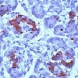 Anti-PMP22 antibody used in IHC (Paraffin sections) (IHC-P). GTX15506