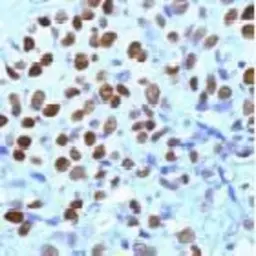 Anti-Progesterone Receptor antibody (ready-to-use) used in IHC (Paraffin sections) (IHC-P). GTX15510