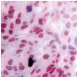 Anti-Retinoid X Receptor gamma antibody used in IHC (Paraffin sections) (IHC-P). GTX15518