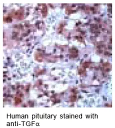 Anti-TGF alpha antibody used in Immunohistochemistry (IHC). GTX15541
