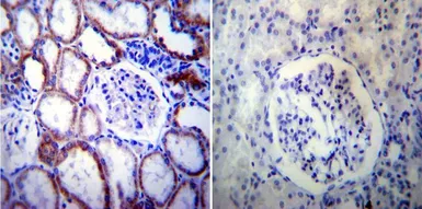 Anti-Presenilin 2 antibody [APS 21] used in IHC (Paraffin sections) (IHC-P). GTX15548