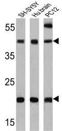 Anti-Presenilin 2 antibody [APS 21] used in Western Blot (WB). GTX15548