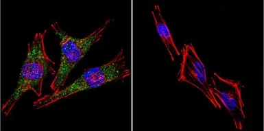 Anti-Presenilin 2 antibody [APS 21] used in Immunocytochemistry/ Immunofluorescence (ICC/IF). GTX15548