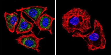 Anti-Presenilin 2 antibody [APS 21] used in Immunocytochemistry/ Immunofluorescence (ICC/IF). GTX15548