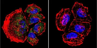 Anti-Presenilin 2 antibody [APS 21] used in Immunocytochemistry/ Immunofluorescence (ICC/IF). GTX15548