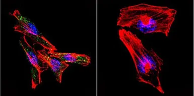Anti-Presenilin 2 antibody [APS 26] used in Immunocytochemistry/ Immunofluorescence (ICC/IF). GTX15549