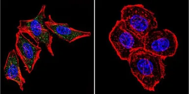 Anti-Presenilin 2 antibody [APS 26] used in Immunocytochemistry/ Immunofluorescence (ICC/IF). GTX15549