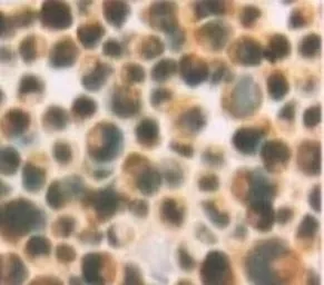 Anti-PRX II antibody used in Immunocytochemistry/ Immunofluorescence (ICC/IF). GTX15572