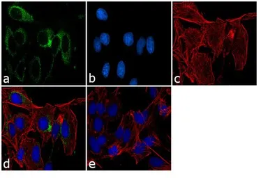 Anti-PRX IV antibody used in Immunocytochemistry/ Immunofluorescence (ICC/IF). GTX15574