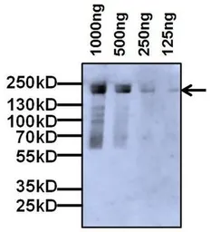 Anti-alpha 2 Macroglobulin antibody [F1-P1C11 #3] used in Western Blot (WB). GTX15643