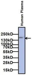 Anti-alpha 2 Macroglobulin antibody [F1-P1C11 #3] used in Western Blot (WB). GTX15643