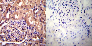 Anti-alpha Actinin 4 antibody [7H6] used in IHC (Paraffin sections) (IHC-P). GTX15648