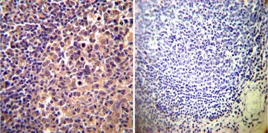 Anti-alpha Actinin 4 antibody [7H6] used in IHC (Paraffin sections) (IHC-P). GTX15648