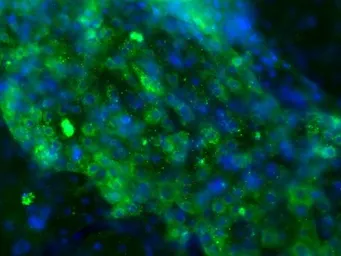 Anti-Alpha fetoprotein / AFP antibody [P5B8] used in Immunocytochemistry/ Immunofluorescence (ICC/IF). GTX15650