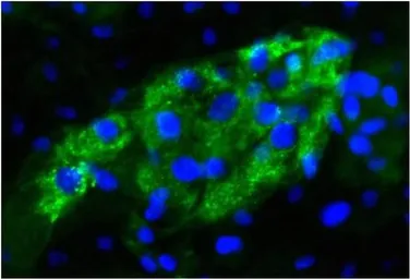 Anti-Alpha fetoprotein / AFP antibody [P5B8] used in Immunocytochemistry/ Immunofluorescence (ICC/IF). GTX15650