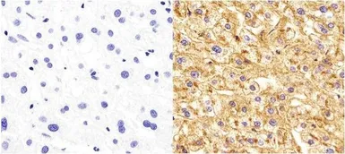 Anti-Apolipoprotein A1 antibody [513] used in IHC (Paraffin sections) (IHC-P). GTX15658