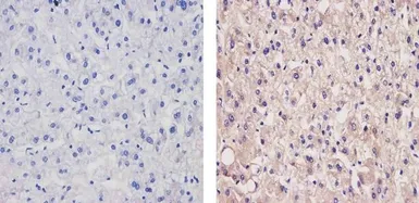 Anti-Apolipoprotein B antibody [F2C3] used in IHC (Paraffin sections) (IHC-P). GTX15665