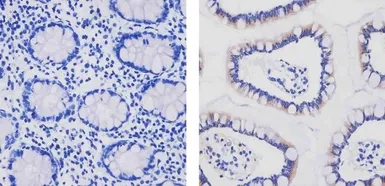 Anti-Apolipoprotein B antibody [F2C3] used in IHC (Paraffin sections) (IHC-P). GTX15665