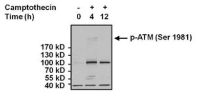 Anti-ATM (phospho Ser1981) antibody [10H11] used in Western Blot (WB). GTX15666