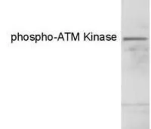 Anti-ATM (phospho Ser1981) antibody [10H11] used in Western Blot (WB). GTX15666
