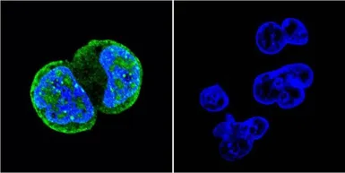 Anti-ATM (phospho Ser1981) antibody [10H11] used in Immunocytochemistry/ Immunofluorescence (ICC/IF). GTX15666