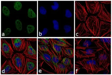 Anti-ATM (phospho Ser1981) antibody [10H11] used in Immunocytochemistry/ Immunofluorescence (ICC/IF). GTX15666