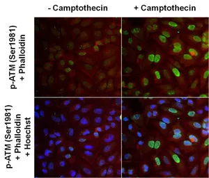 Anti-ATM (phospho Ser1981) antibody [10H11] used in Immunocytochemistry/ Immunofluorescence (ICC/IF). GTX15666