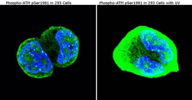 Anti-ATM (phospho Ser1981) antibody [10H11] used in Immunocytochemistry/ Immunofluorescence (ICC/IF). GTX15666