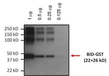 Anti-Bid antibody [23F7] used in Western Blot (WB). GTX15667