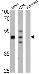 Anti-CD2 antibody [TS2/18] used in Western Blot (WB). GTX15668