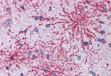 Anti-BAIAP2 (isoform 1) antibody, C-term used in IHC (Paraffin sections) (IHC-P). GTX15697