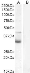 Anti-Wnt4 antibody, Internal used in Western Blot (WB). GTX15699
