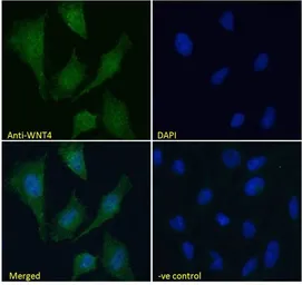 Anti-Wnt4 antibody, Internal used in Immunocytochemistry/ Immunofluorescence (ICC/IF). GTX15699