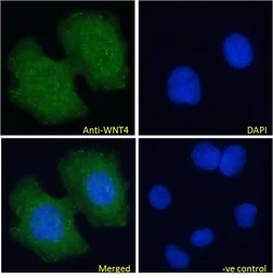 Anti-Wnt4 antibody, Internal used in Immunocytochemistry/ Immunofluorescence (ICC/IF). GTX15699