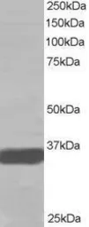 Anti-Mortality factor 4 like 2 antibody, N-term used in Western Blot (WB). GTX15700