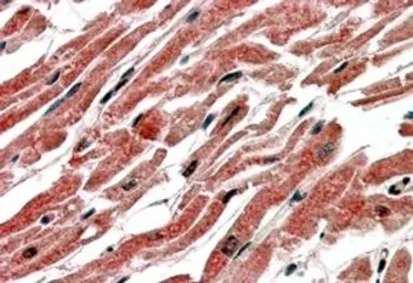 Anti-CPT1B (isoform 1) antibody, C-term used in IHC (Paraffin sections) (IHC-P). GTX15703
