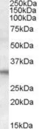 Anti-FHL2 antibody, C-term used in Western Blot (WB). GTX15715