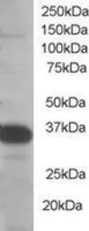 Anti-SMUG1 antibody, N-term used in Western Blot (WB). GTX15716