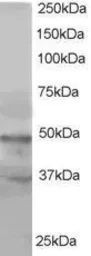 Anti-BAF53A + BAF53B antibody used in Western Blot (WB). GTX15718