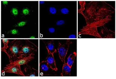 Anti-CREB antibody [LB9] used in Immunocytochemistry/ Immunofluorescence (ICC/IF). GTX15731