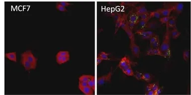 Anti-Ferritin antibody [321B7] used in Immunocytochemistry/ Immunofluorescence (ICC/IF). GTX15743