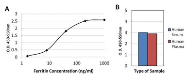 Anti-Ferritin antibody [523] used in ELISA (ELISA). GTX15744