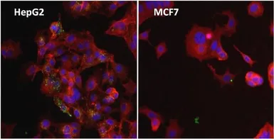 Anti-Ferritin antibody [513C10] used in Immunocytochemistry/ Immunofluorescence (ICC/IF). GTX15745