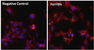 Anti-Ferritin antibody [101] used in Immunocytochemistry/ Immunofluorescence (ICC/IF). GTX15746