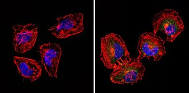 Anti-CD18 antibody [TS1/18] used in Immunocytochemistry/ Immunofluorescence (ICC/IF). GTX15770