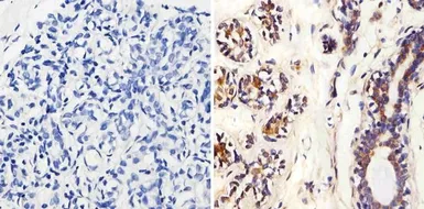 Anti-MMP2 antibody [MMP2/2C1-1D12] used in IHC (Paraffin sections) (IHC-P). GTX15773