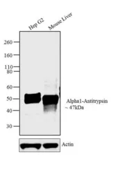 Anti-alpha 1 Antitrypsin antibody [TMF1#4B5] used in Western Blot (WB). GTX15777
