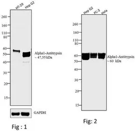 Anti-alpha 1 Antitrypsin antibody [TMF1#4B5] used in Western Blot (WB). GTX15777